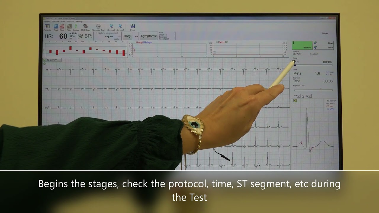 STRESS TEST MODEL CS 200 CLASSIC
