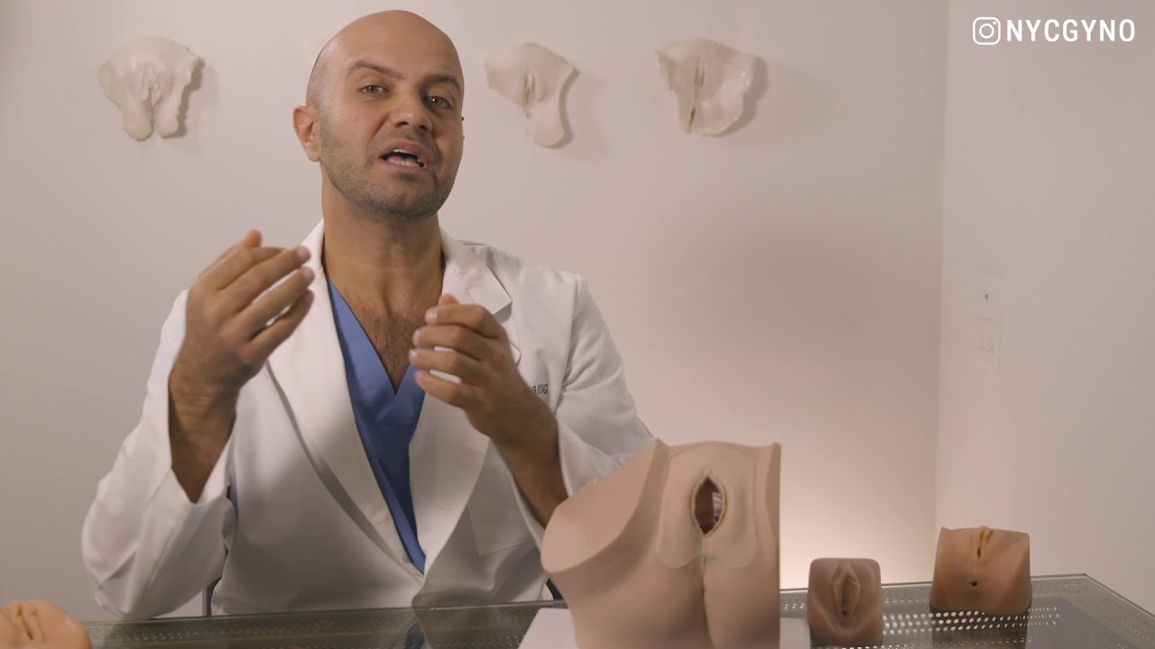Which Fibroids need to be removed?