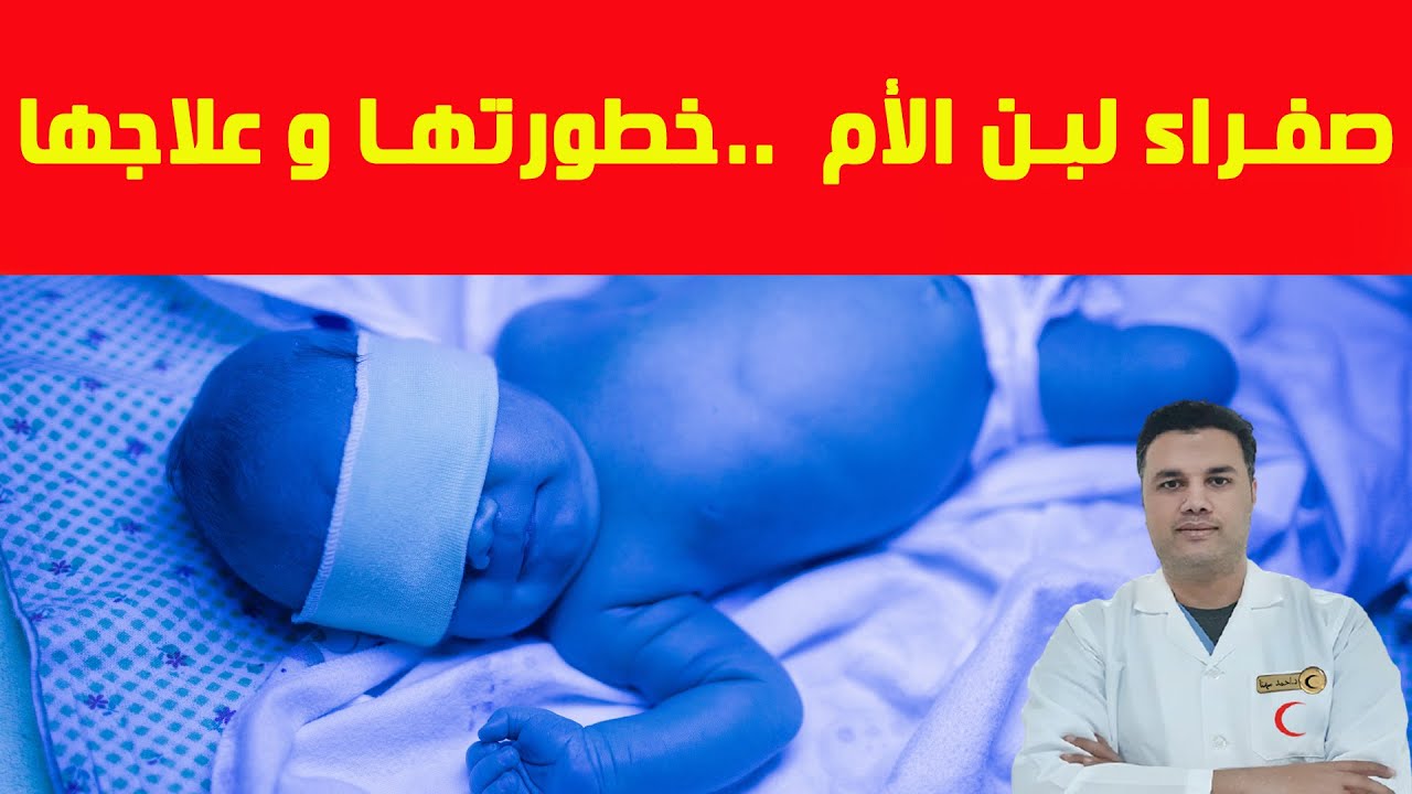 لمصلحة ابنك..علاج الصفراء عند حديثى الولادة بسبب لبن الام وتأثيرها على الطفل والرضاعة الطبيعية