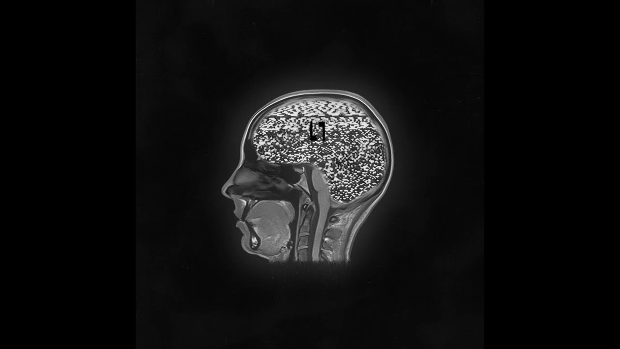 LLAAPPSSEE - Headful of Static
