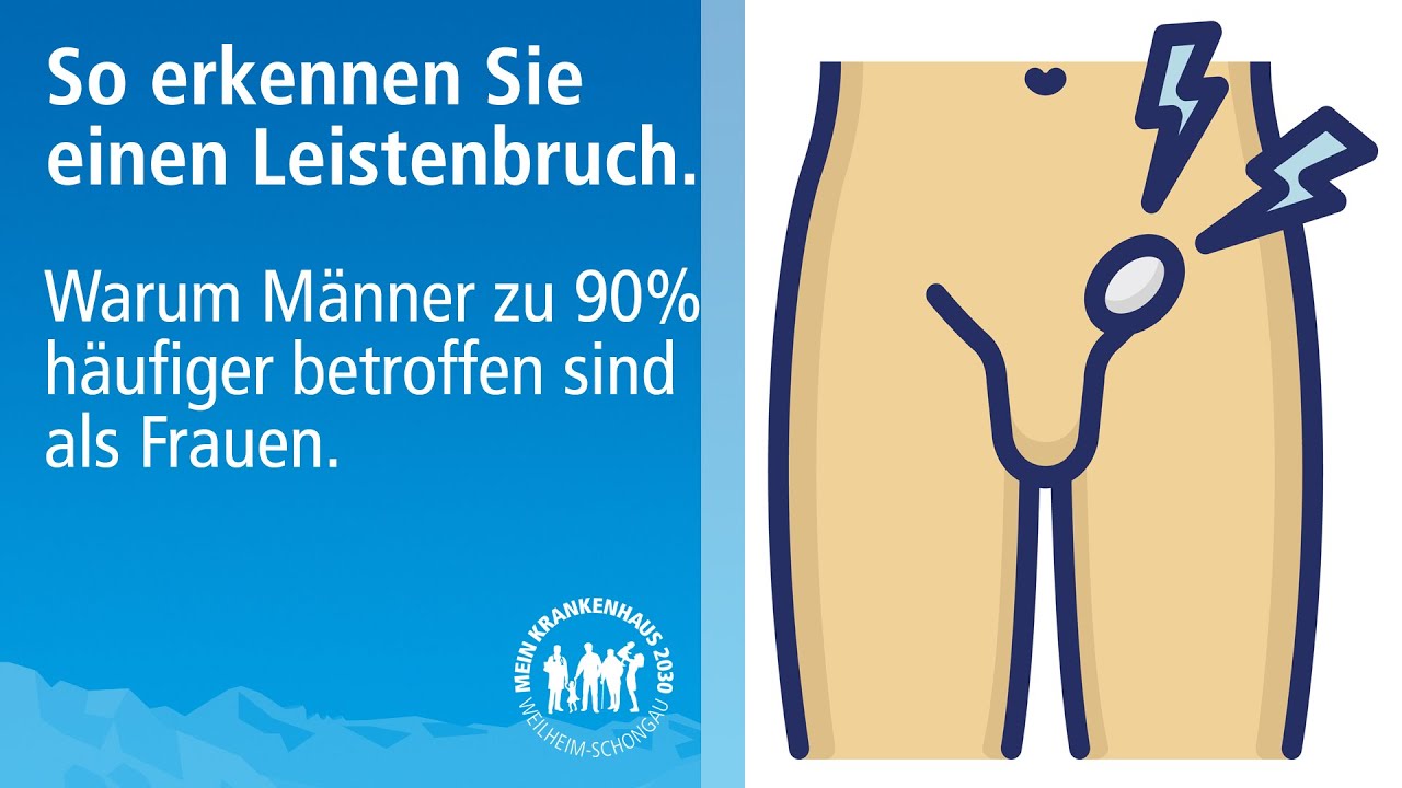 Leistenbruch erkennen & Symptome: Welche Gefahren bringt ein Leistenbruch mit sich?