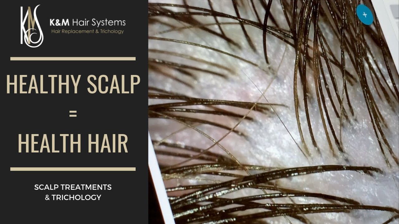 HEALTHY SCALP = HEALTHY HAIR - TRICHOLOGY