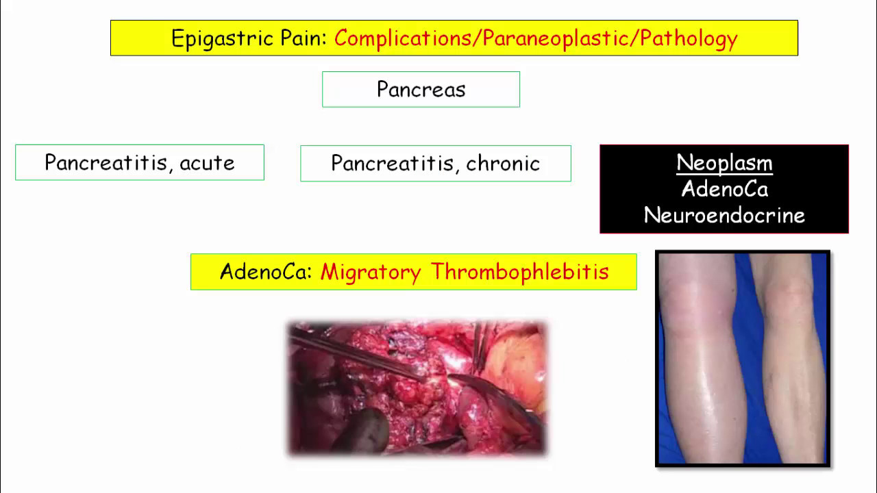 12DaysinMarch, Epigastric Pain and Pancreatic Disorders for USMLE Step One