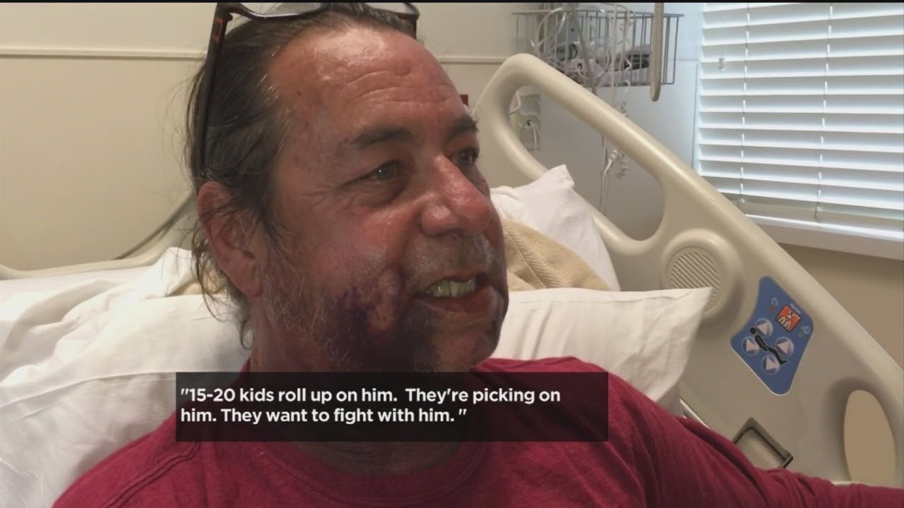 Man Says He Was Beaten By Teens For Trying To Stop Fight At Skate Park