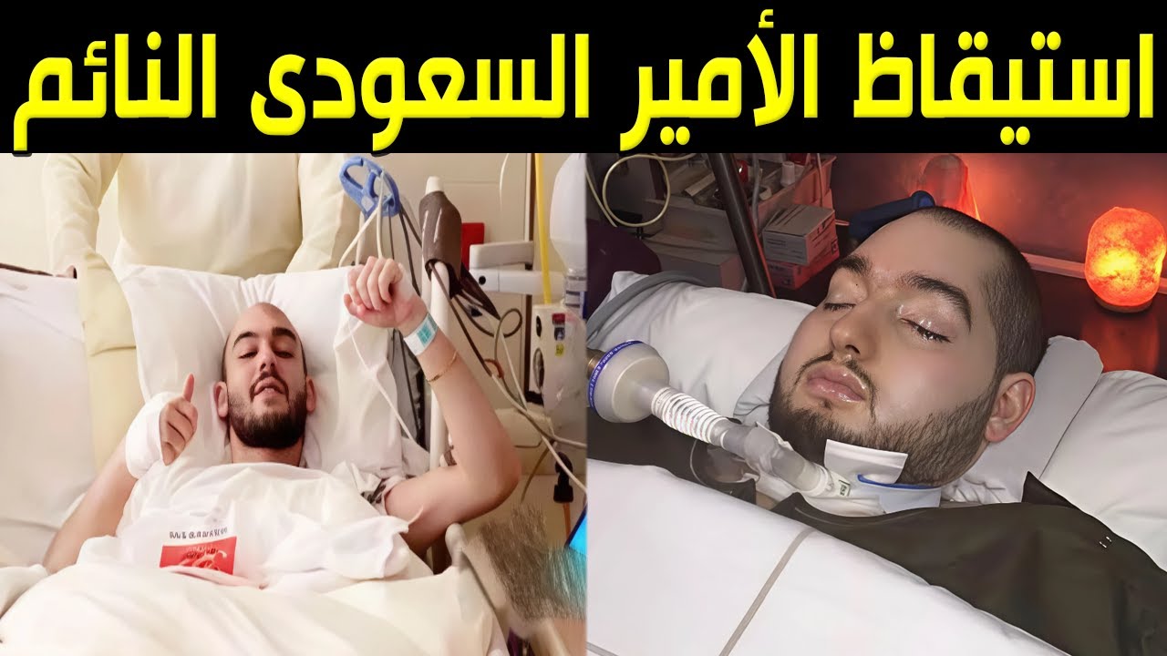 شاهد مقطع فيديو يوثق استيقاظ الأمير السعودي النائم الوليد بن خالد بعد غيبوبة دامت 20 وهذه حقيقته ؟!!