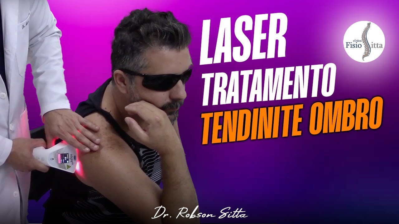LASERTERAPIA TENDINITE do MANGUITO ROTADOR do OMBRO - Dr. Robson Sitta