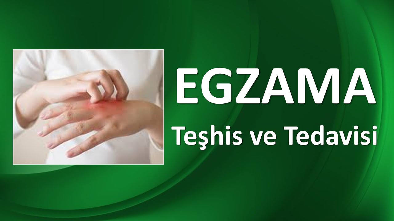EGZAMA NEDİR? ÇEŞİTLERİ NELERDİR? NASIL TEDAVİ EDİLİR?