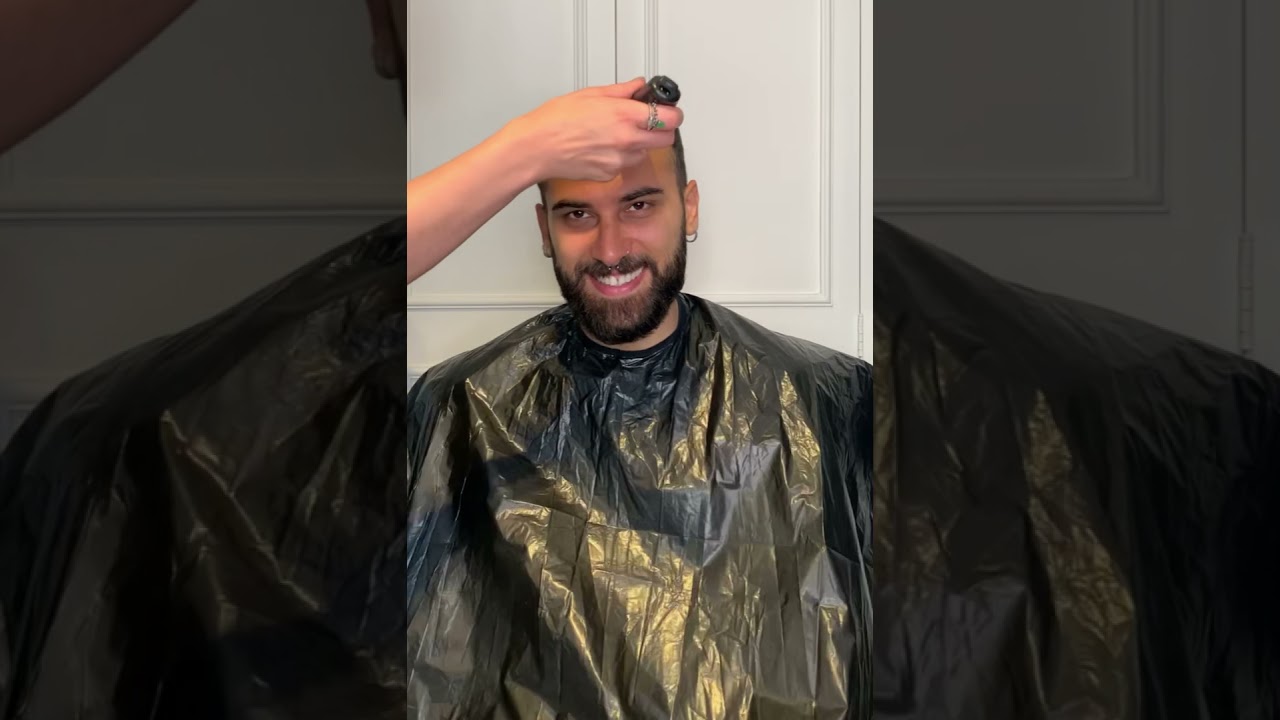 Está ficando careca, e agora? O que fazer? (A verdade que nunca te contaram)