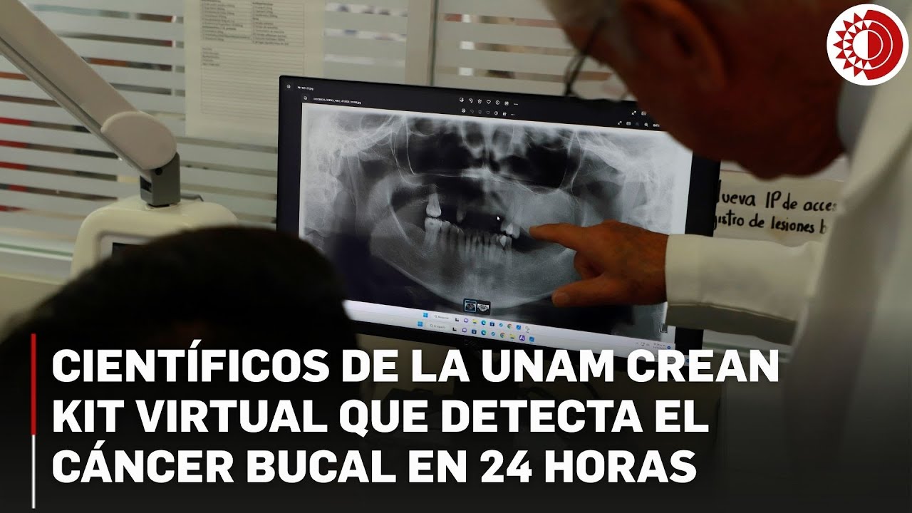 UNAM desarrolla innovador sistema para la detección oportuna del cáncer bucal