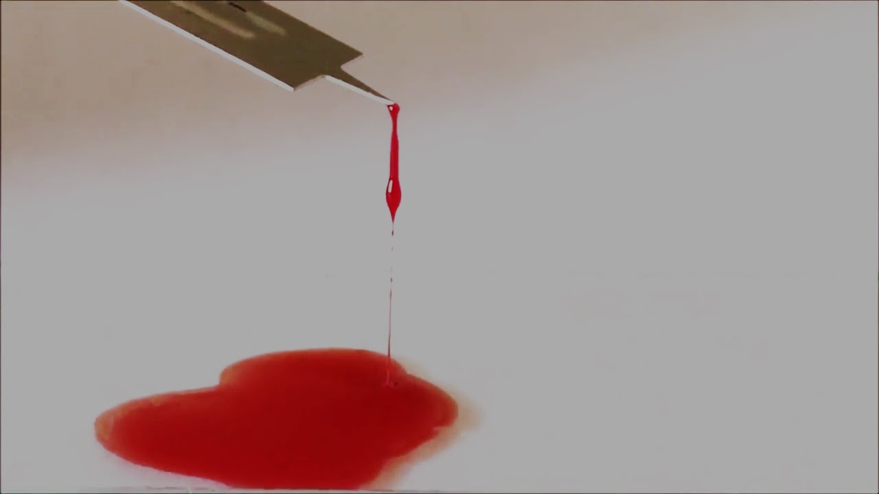 Determination of Blood Clotting Time By Slide Method | Blood Clotting Time Determination | ENGLISH