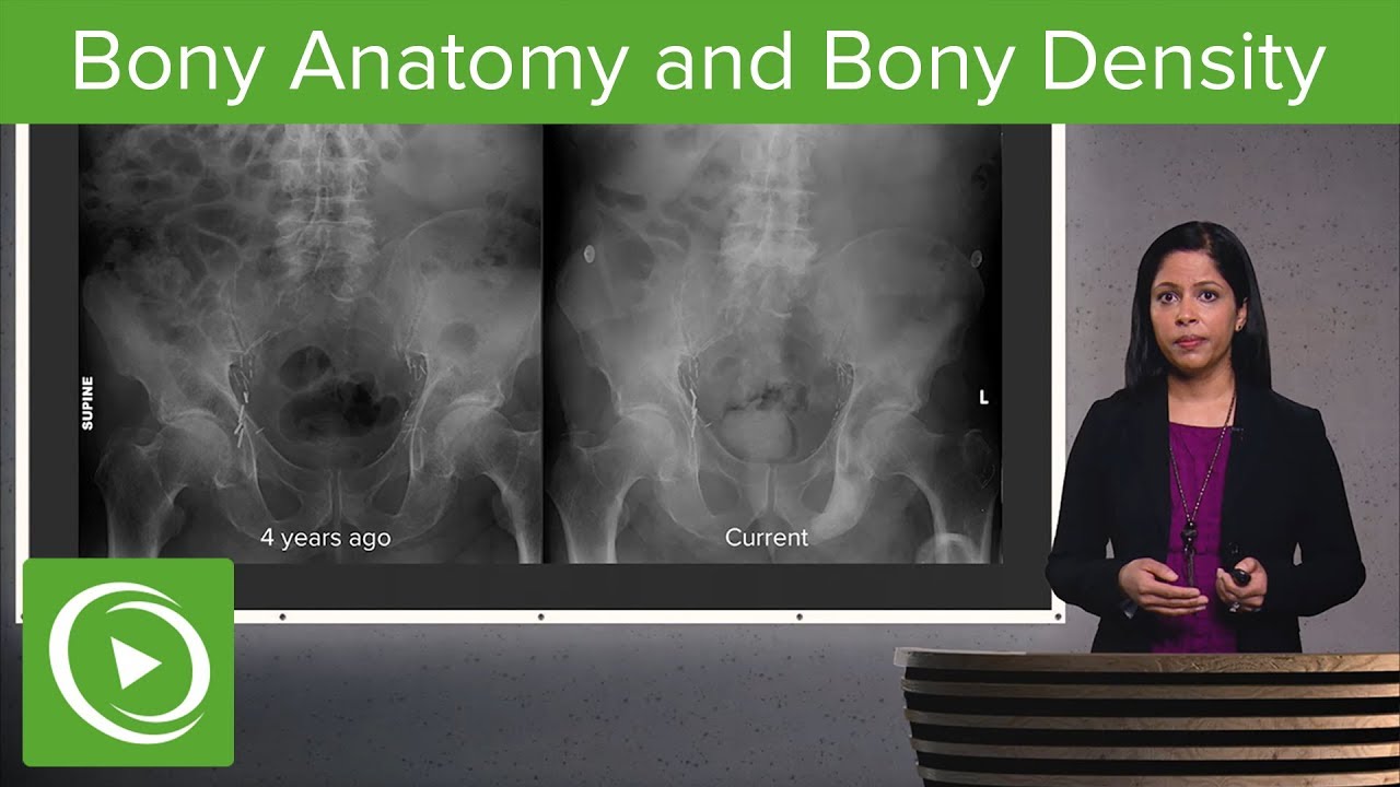 Imaging of Bones: Fractures, Bony Anatomy and Bony Density – Radiology | Lecturio