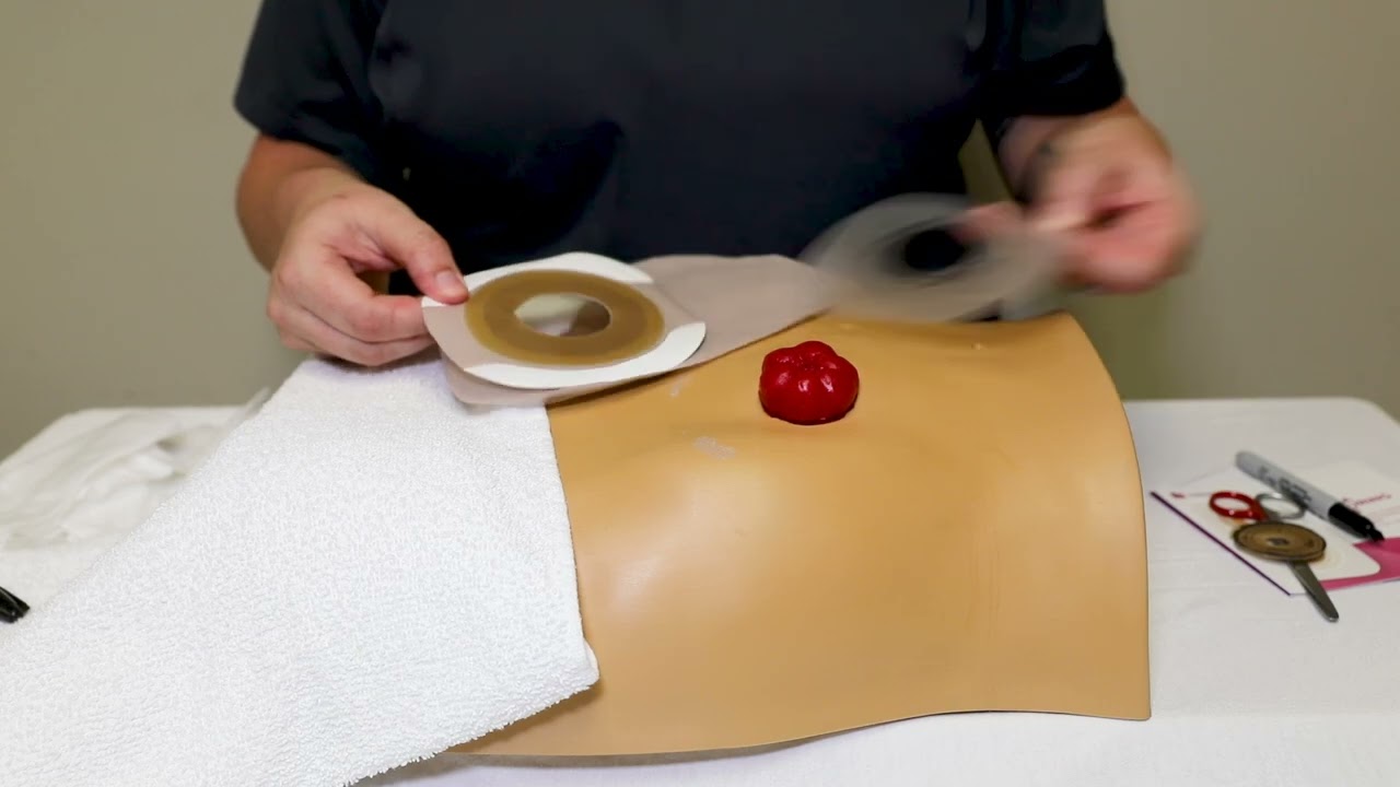 How to Change a 1-Piece Ostomy Pouch