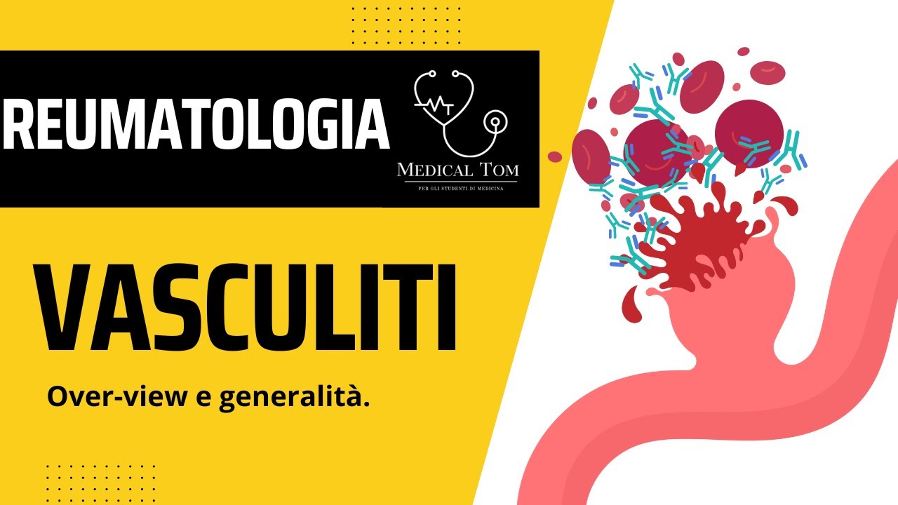 Vasculiti | Over-view e Generalità.