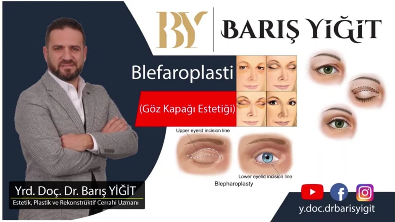 🇹🇷 G&ouml;z Kapağı Estetiği (Blefaroplasti) 🇬🇧 Eye Lid Surgery (Blepharoplasty)