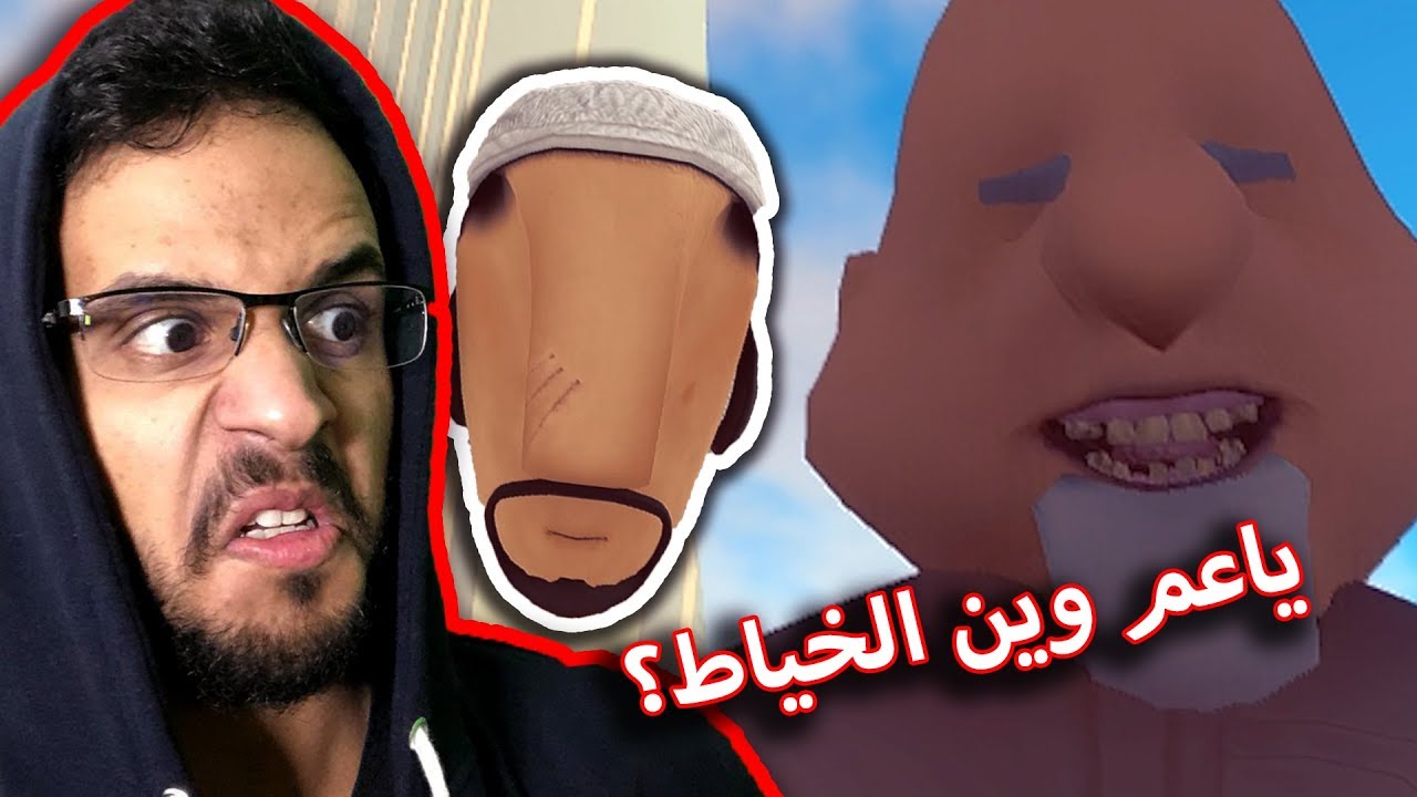مفصخ واحتاج خياط!(وصدمتني سيارة🚗) -  أبو خشم🤥