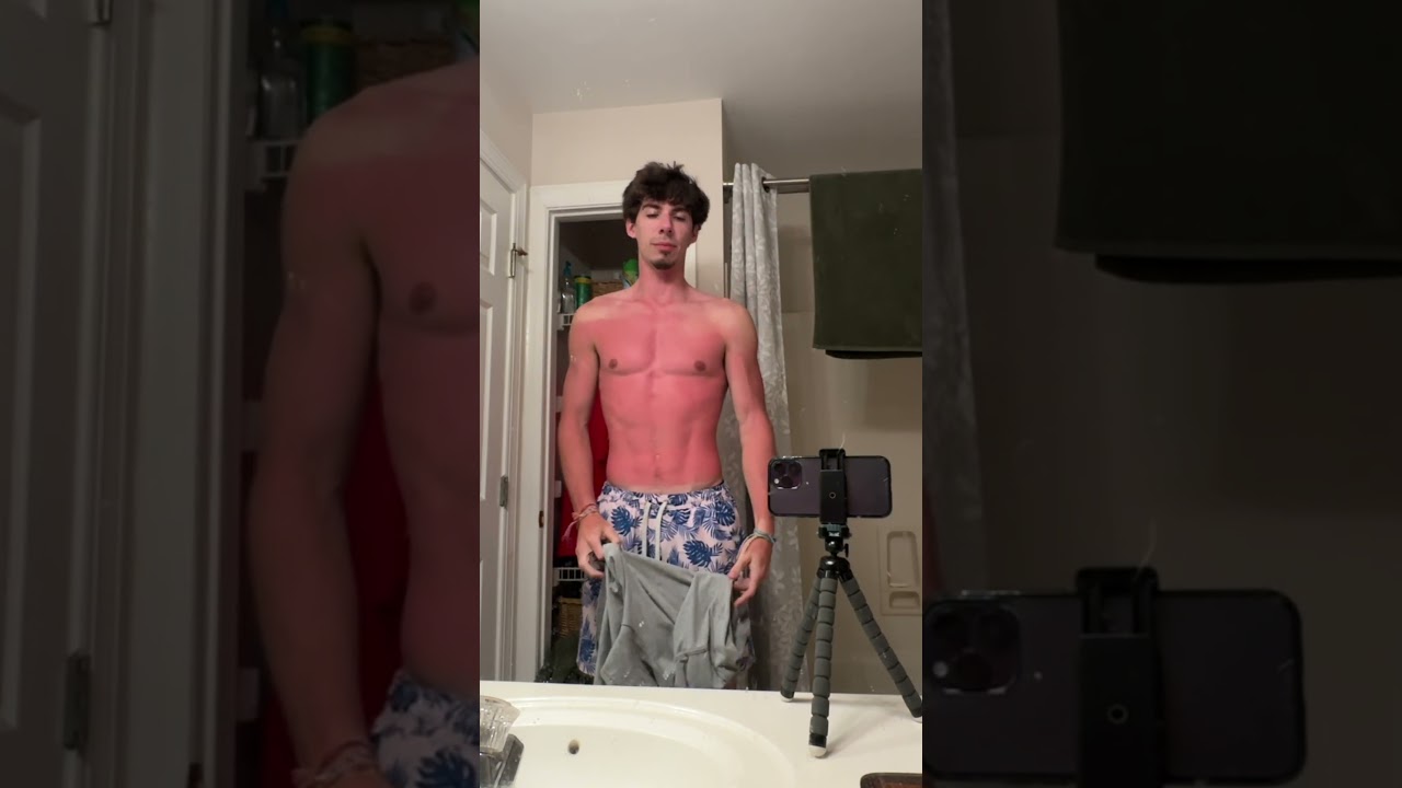 I got SO burned