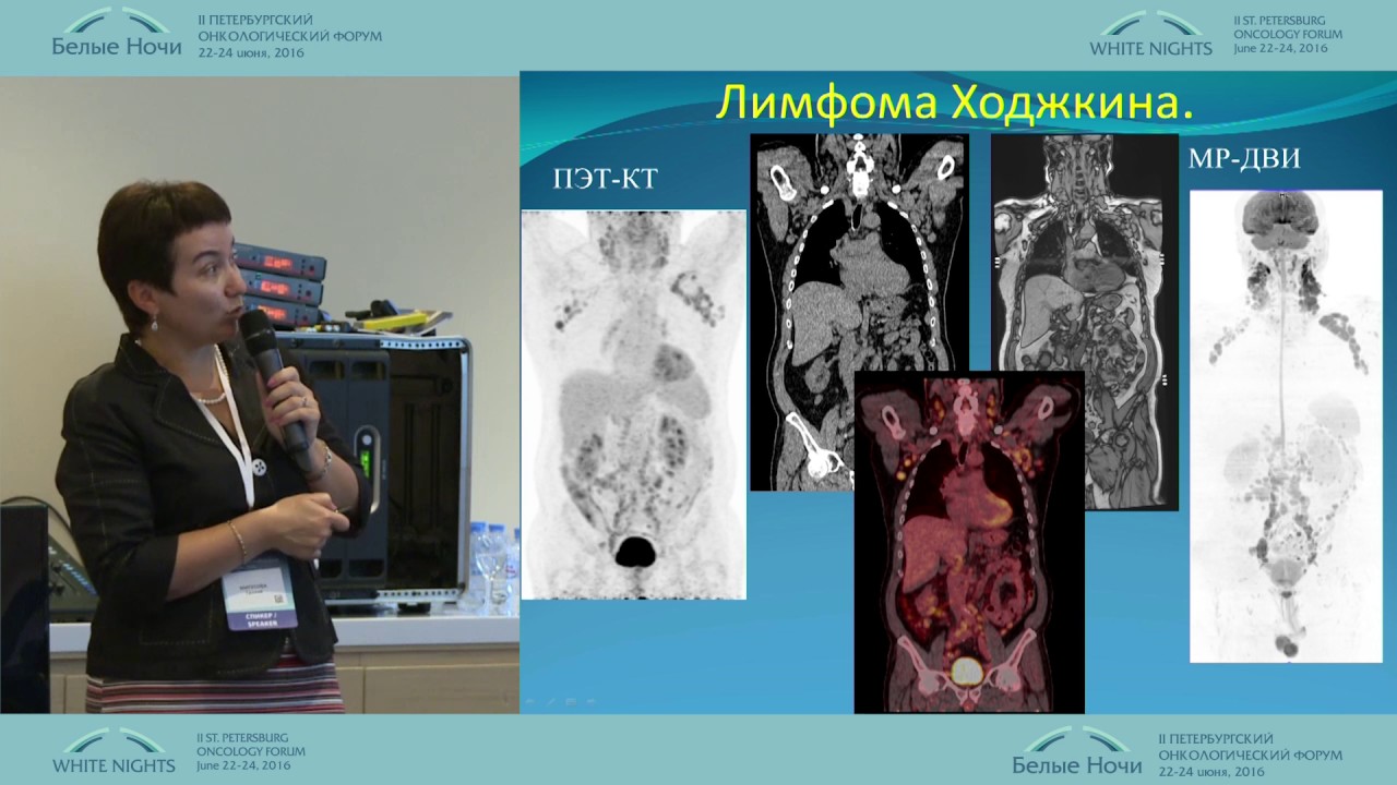 ПЭТ/КТ и МР-диффузия в диагностике метастатического поражения при онкологических заболеваний