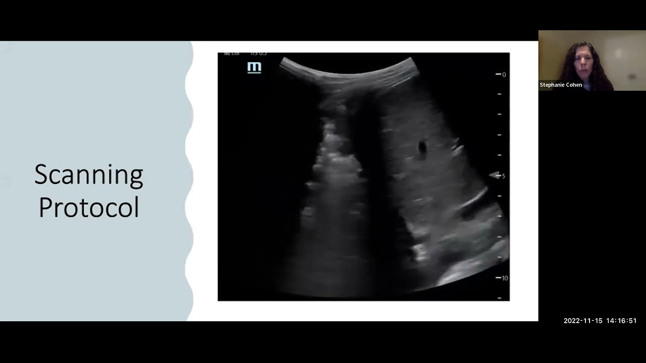 ACEP/SAEM National US Journal Club: Probing the Literature - Pediatric US (November  15th, 2022)