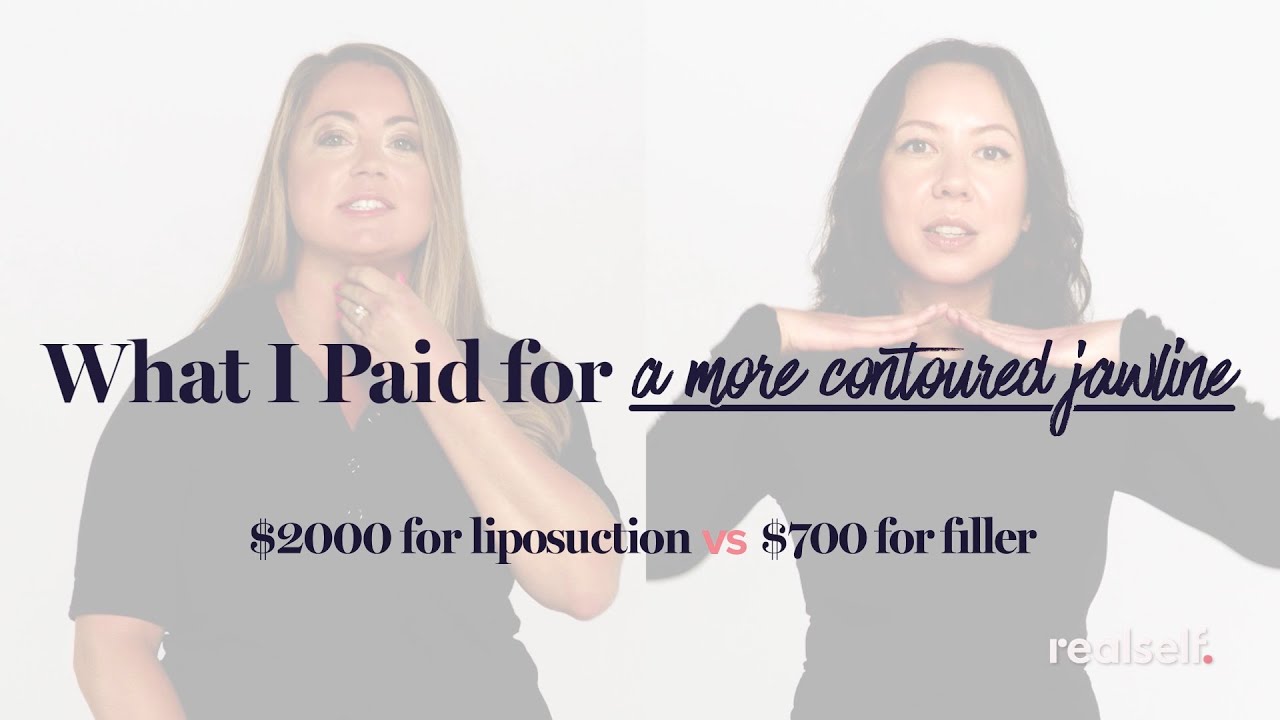 How Much Does a Contoured Jawline Cost? Two Women Share What They Paid for Chin Lipo and Chin Filler