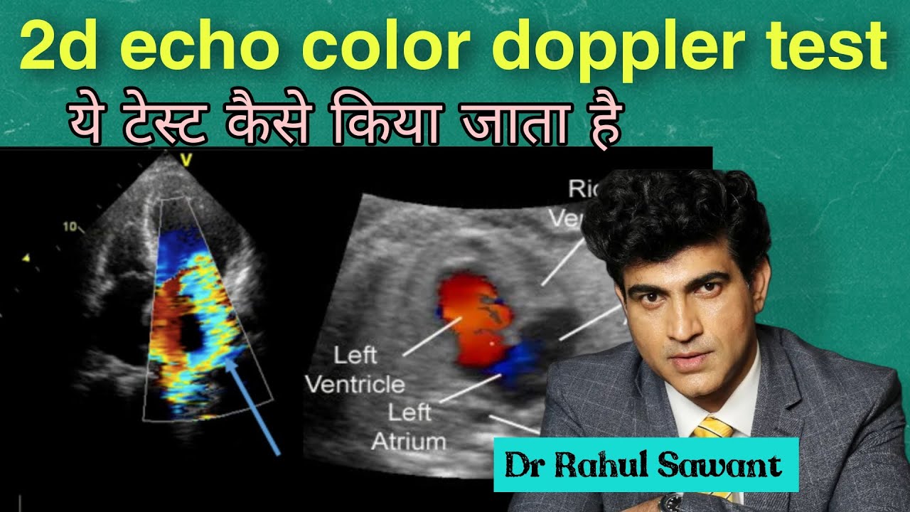 2d echo color doppler test | Full Explanation of 2d echo color Doppler Test