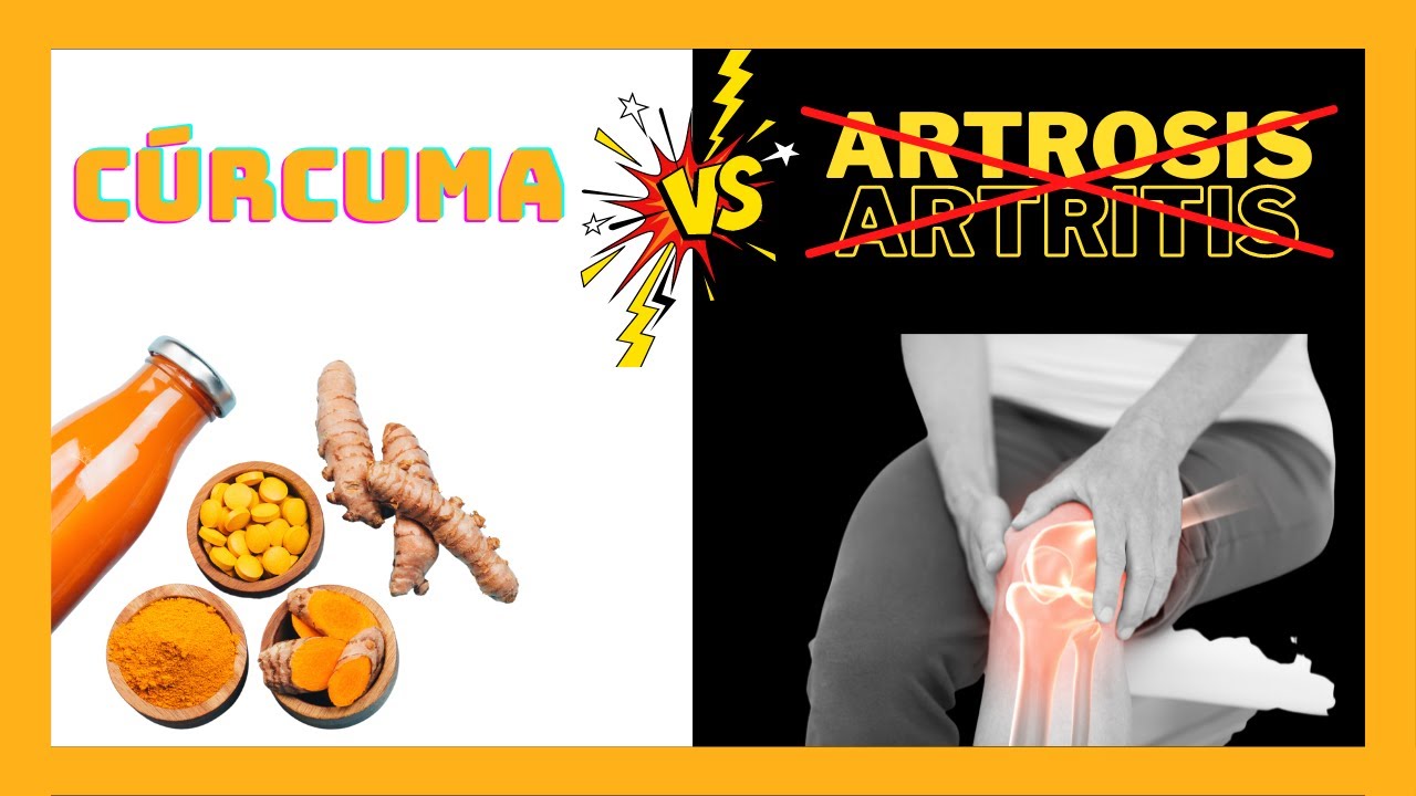 ¿𝗦𝗲𝗿á 𝗯𝘂𝗲𝗻𝗮 𝗹𝗮 𝗖Ú𝗥𝗖𝗨𝗠𝗔 𝗽𝗮𝗿𝗮 𝗹𝗮 𝗔𝗥𝗧𝗥𝗢𝗦𝗜𝗦 𝘆 𝗹𝗮 𝗔𝗥𝗧𝗥𝗜𝗧𝗜𝗦? (𝗱𝗼𝘀𝗶𝘀, 𝗲𝗳𝗲𝗰𝘁𝗼𝘀 𝗮𝗱𝘃𝗲𝗿𝘀𝗼𝘀 𝗲 𝗶𝗻𝘁𝗲𝗿𝗮𝗰𝗰𝗶𝗼𝗻𝗲𝘀)