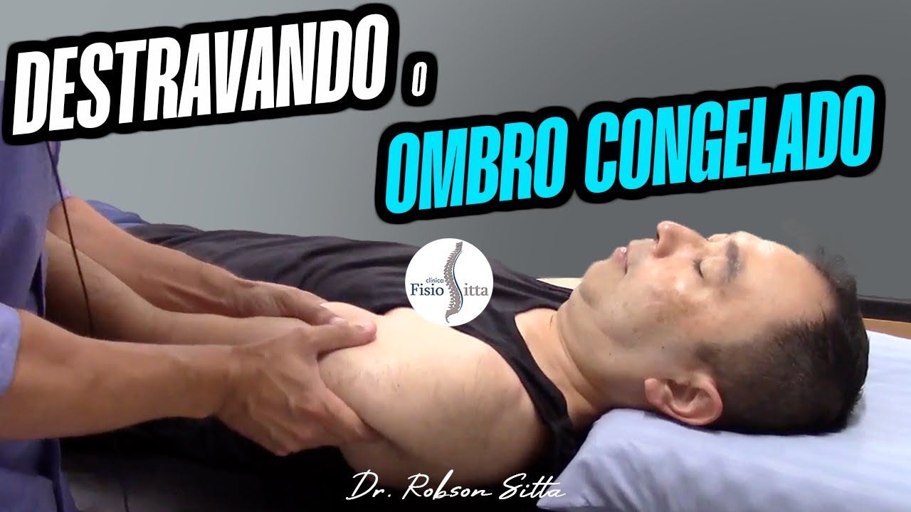 CAPSULITE ADESIVA DO OMBRO - TRATAMENTO DE FISIOTERAPIA Dr. Robson Sitta