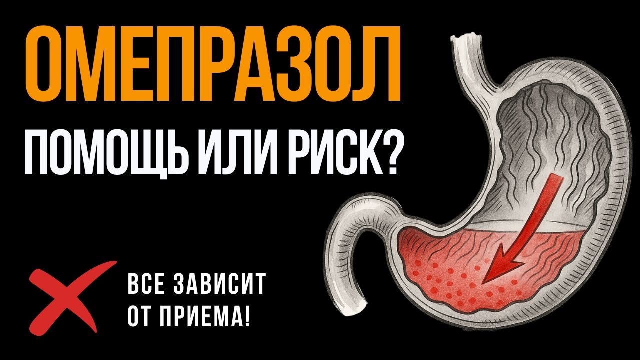 Омепразол: не делайте этих ошибок при гастрите и изжоге!