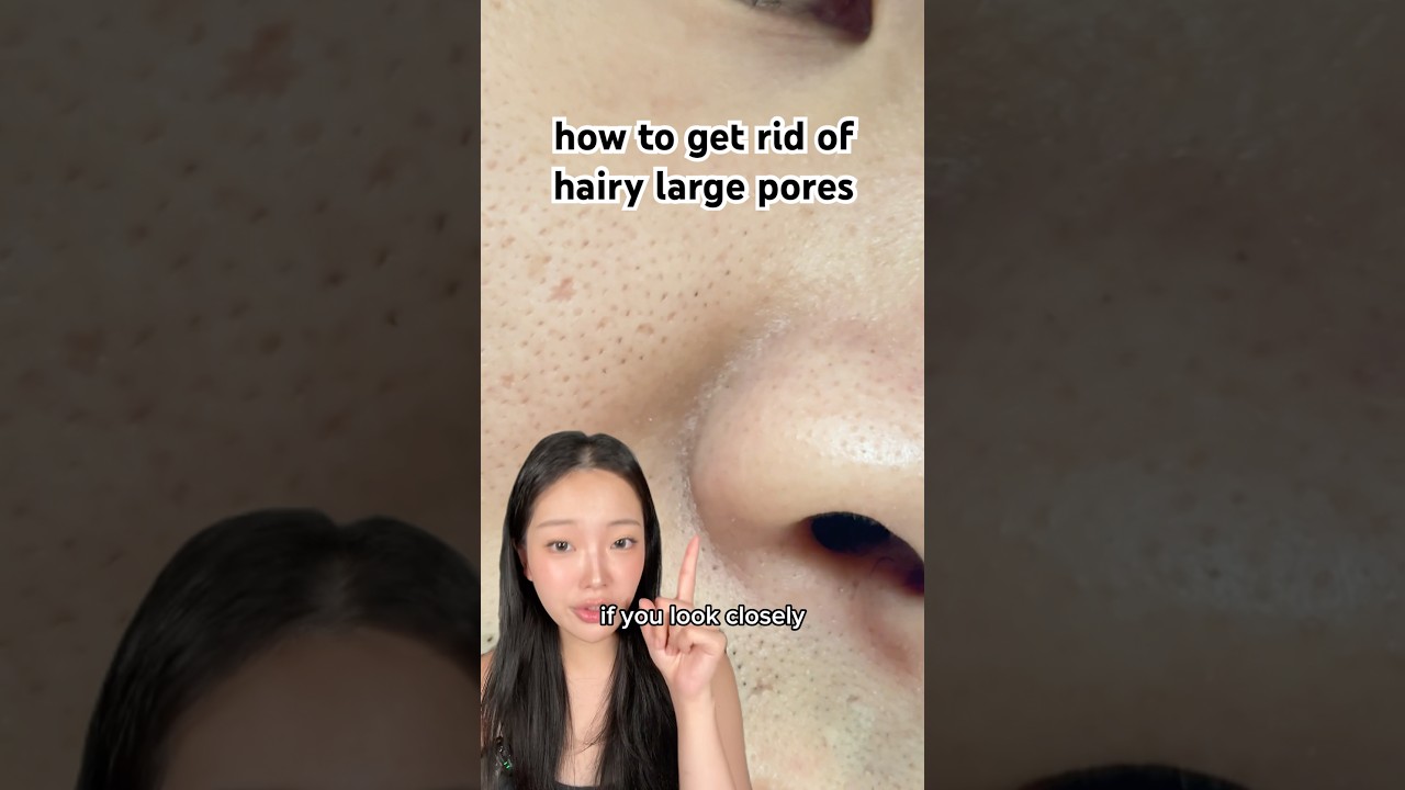 How to get rid of severe hairy large pores! #porecare #glassskin #largepores #kbeauty  #shrinkpores
