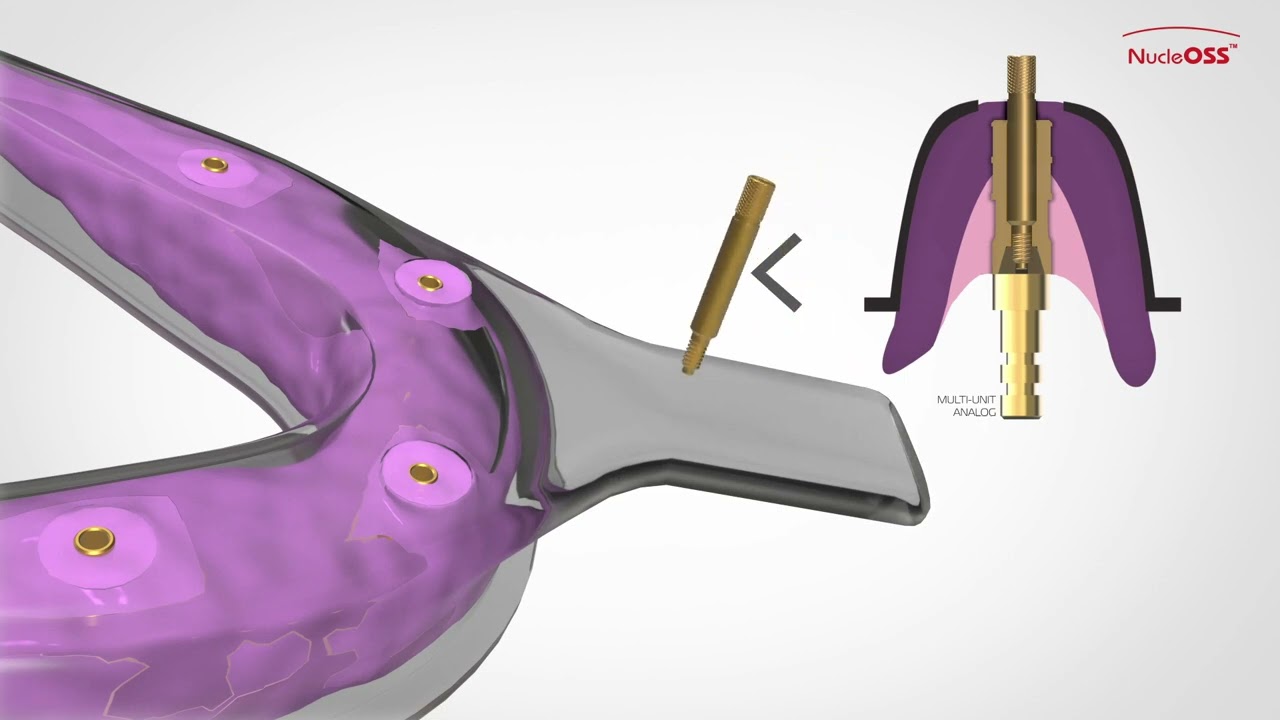 NucleOSS T6 Implant - Vidalı Çözümler - Açık Kaşık Ölçü Parçaları - Kullanım TR