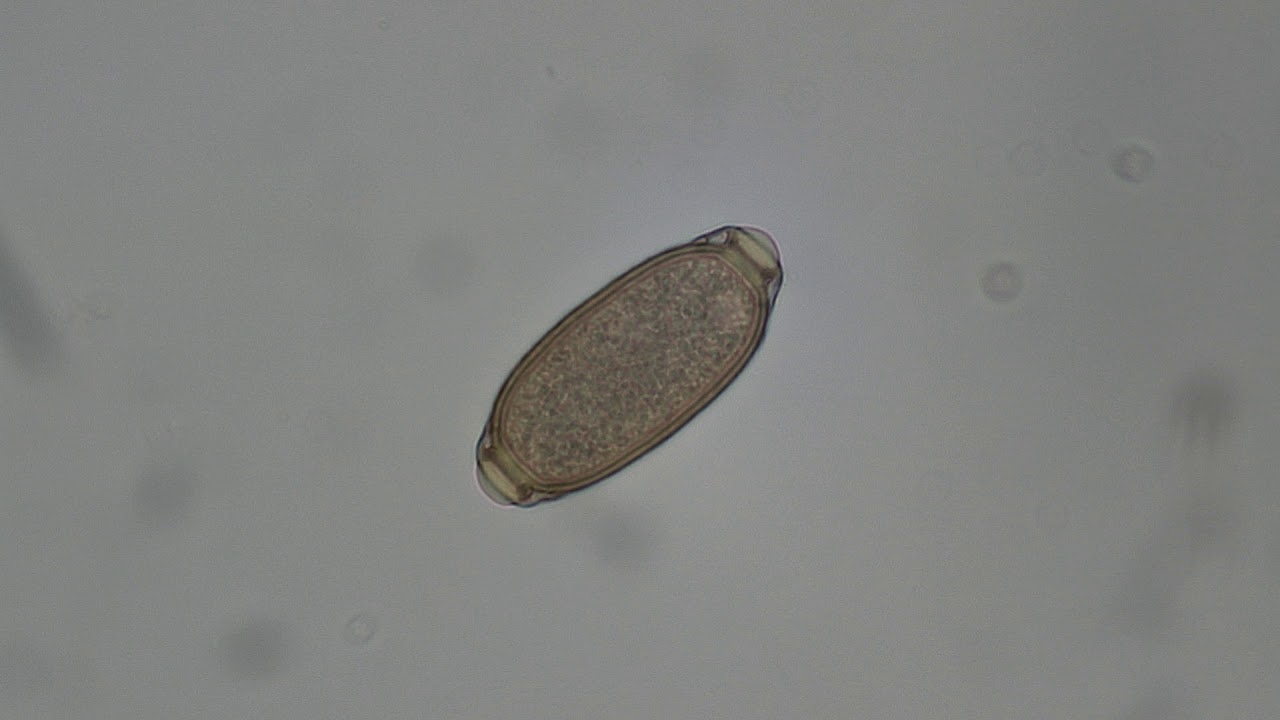 Avian Capillaria