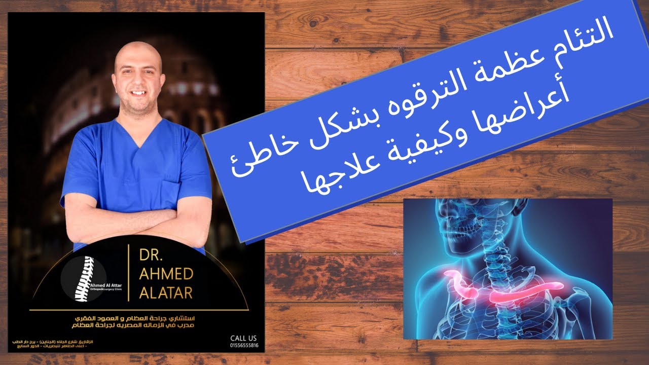 التئام عظمة الترقوه بشكل خاطئ أعراضها وكيفية علاجها (باذن الله) د احمد العطار