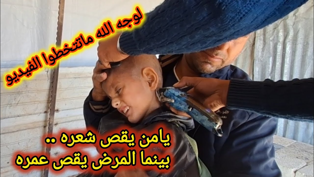 نقص شعر يامن..ونحن عاجزون عن قص الألم من جسده     #اكسبلور #طفولة#كيدز #طفل #قصات #minivlog #ادعموا 