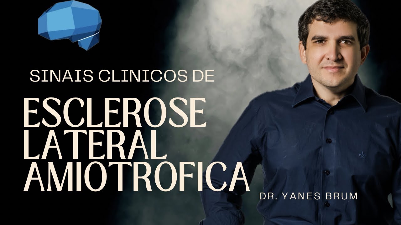 Sinais clínicos de Esclerose Lateral Amiotrófica.