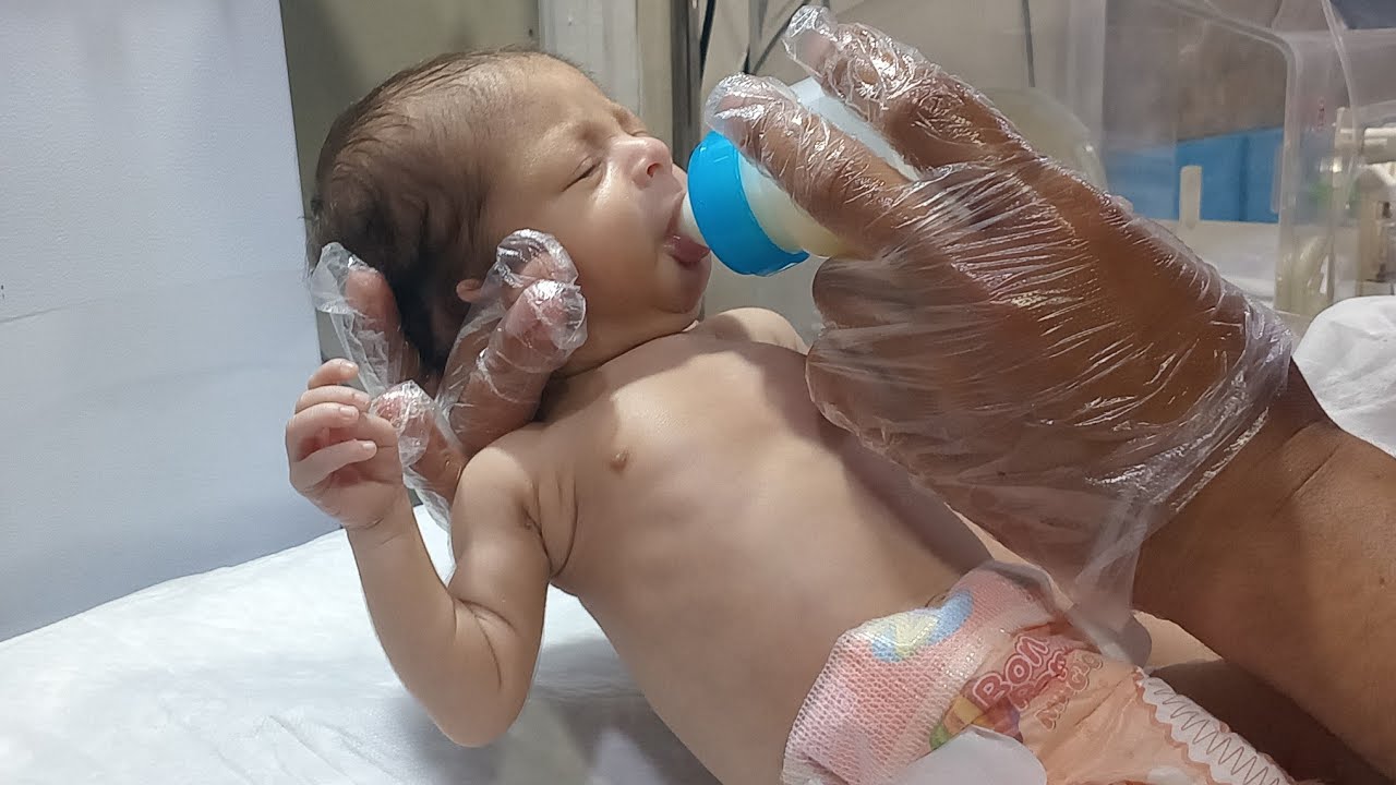 Adorable Baby  Bottle Feeding Trial in NICU Care Stories Daily Update...