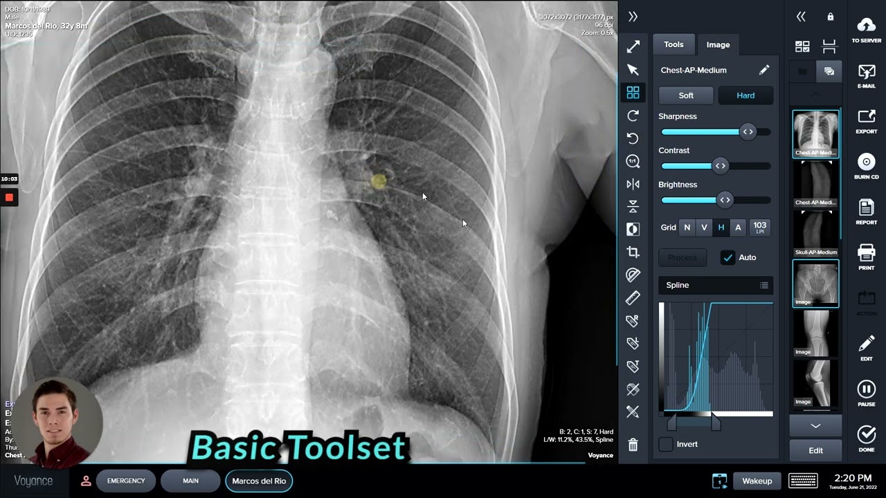 Voyance Digital X-ray - Toolset Full Overview