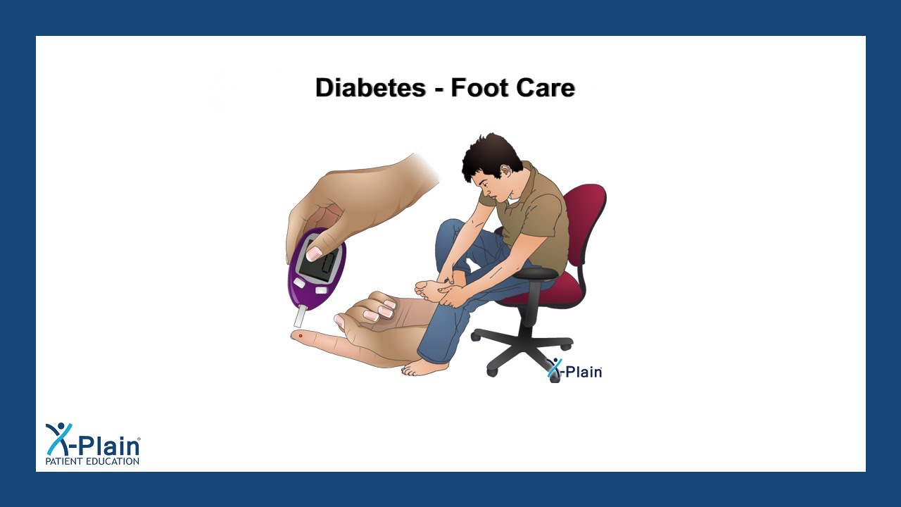 Diabetes - Foot Care (patient education)