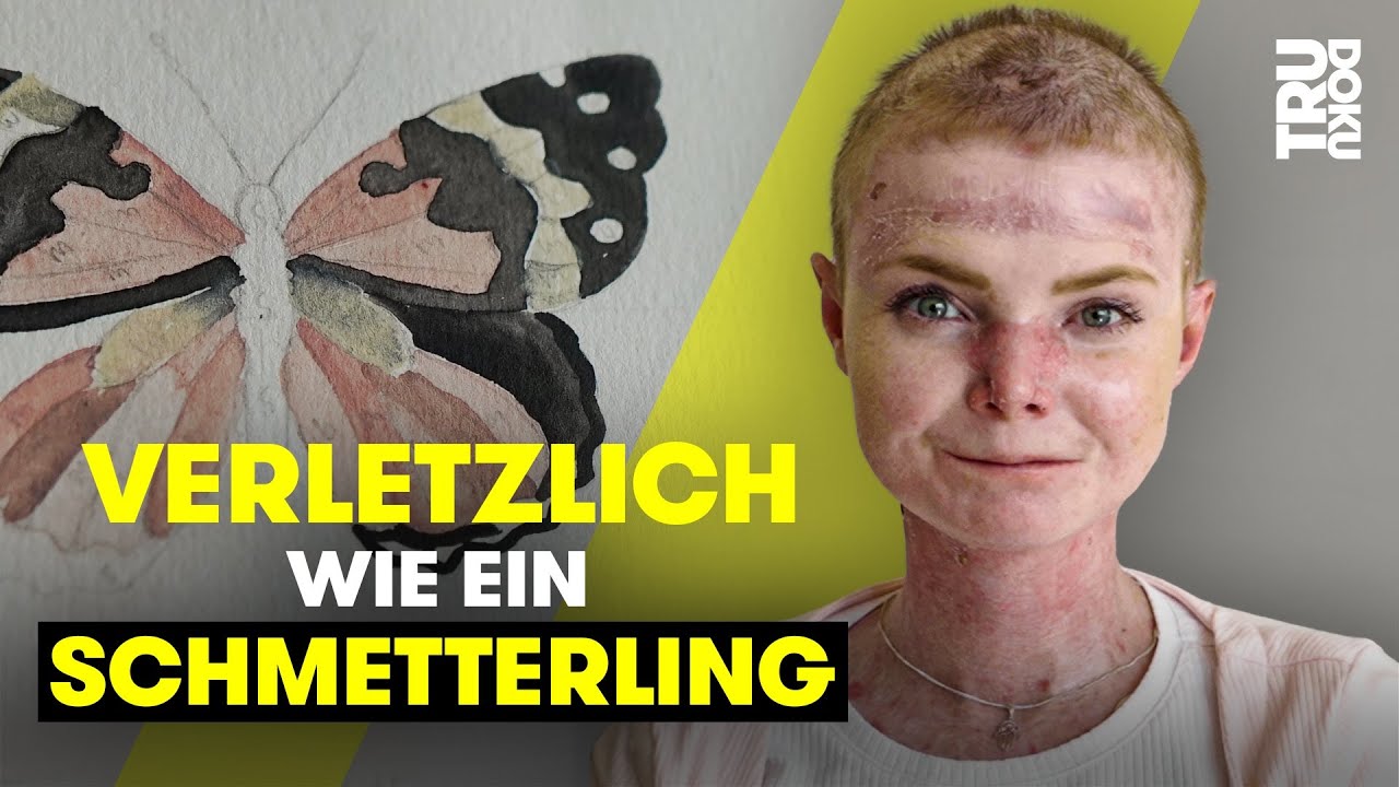 &ldquo;Ich bin mehr als meine Krankheit!&rdquo; - Julia (24) k&auml;mpft f&uuml;r ihre Tr&auml;ume | TRU DOKU