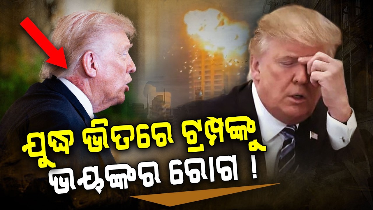 ଯୁଦ୍ଧ ଭିତରେ ଟ୍ରମ୍ପଙ୍କୁ  ଭୟଙ୍କର ରୋଗ ! | Donald Trump | Skin Disease | Argus Digital