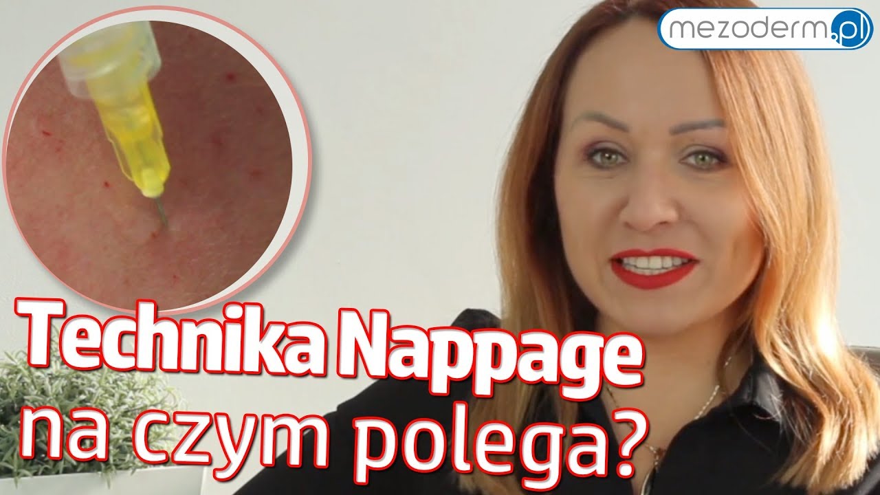 VLOG #18 - Technika Nappage - Jak wygląda skuteczny zabieg? - MEZODERM