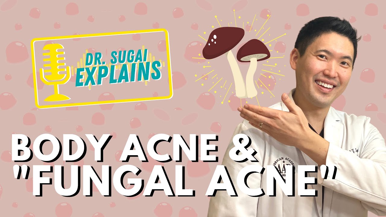 Dr. Sugai Explains: Back Acne and &ldquo;Fungal  Acne&rdquo;- How to Prevent Folliculitis on the Body