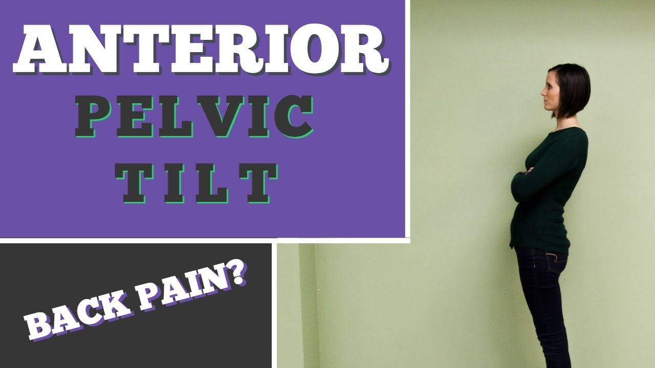 Is Anterior Pelvic Tilt Causing Your Back Pain?