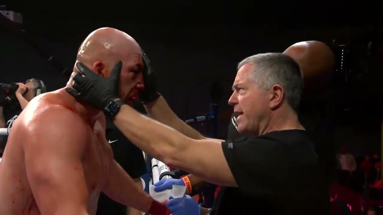BLOODY Bare Knuckle WAR | Cody East vs. Dylan Rush | Full Fight | BYB 35