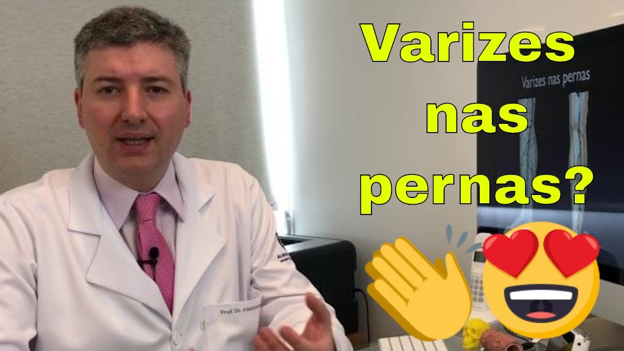 Varizes nas Pernas. VASINHOS, reticulares, veias varicosas