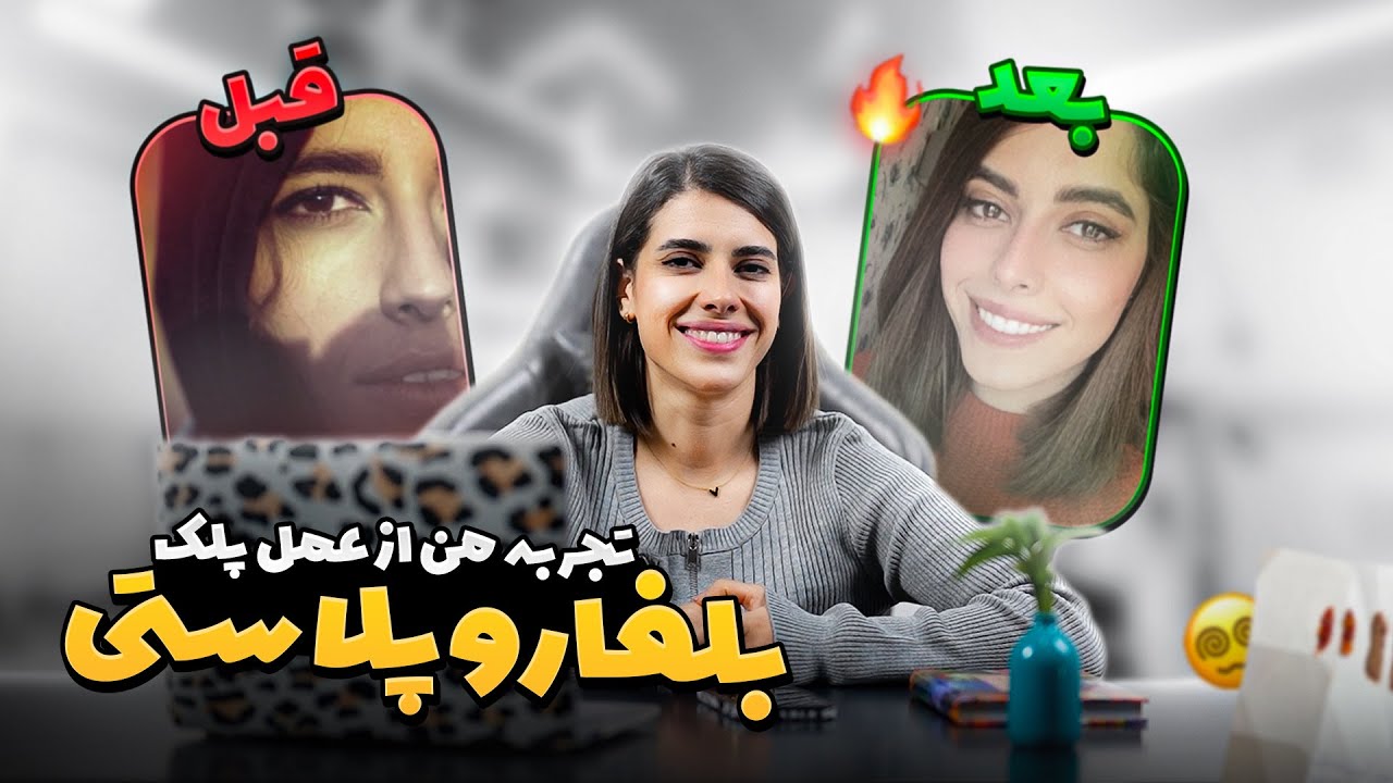 تجربه من از بلفاروپلاستی یا همون عمل پلک !