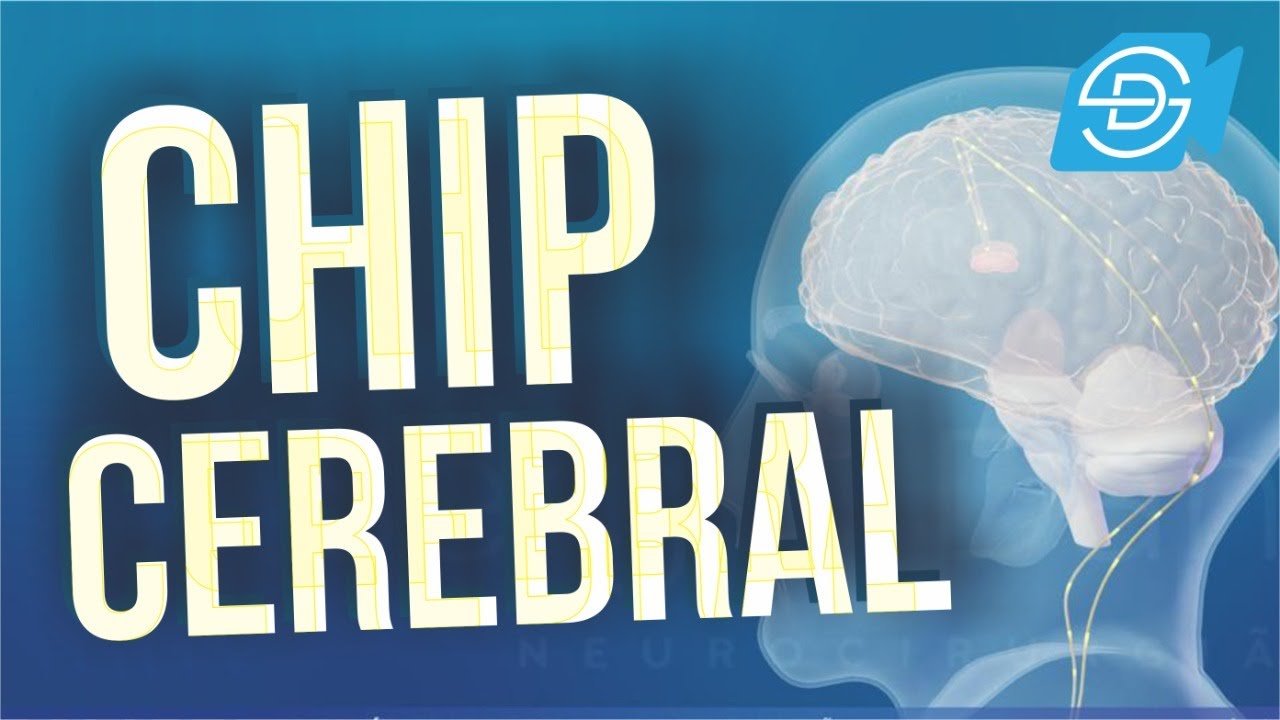 ESTIMULAÇÃO CEREBRAL PROFUNDA - Passo a Passo (Deep Brain Stimulation - step by step) DBS animation