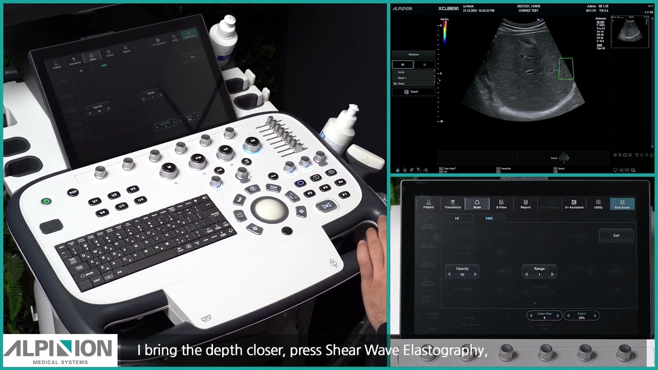 X-CUBE 90 Tutorial: LIVER EXAMINATION