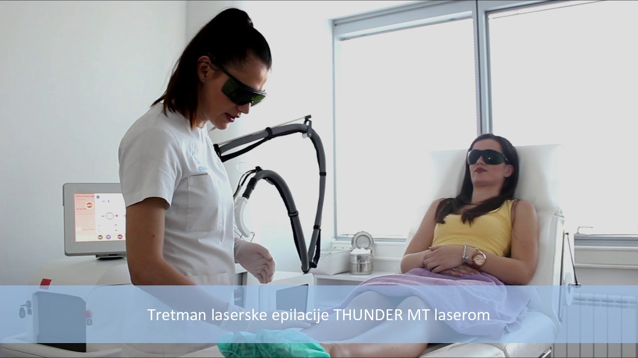 Tretman trajnog uklanjanja dlačica Thunder laserom