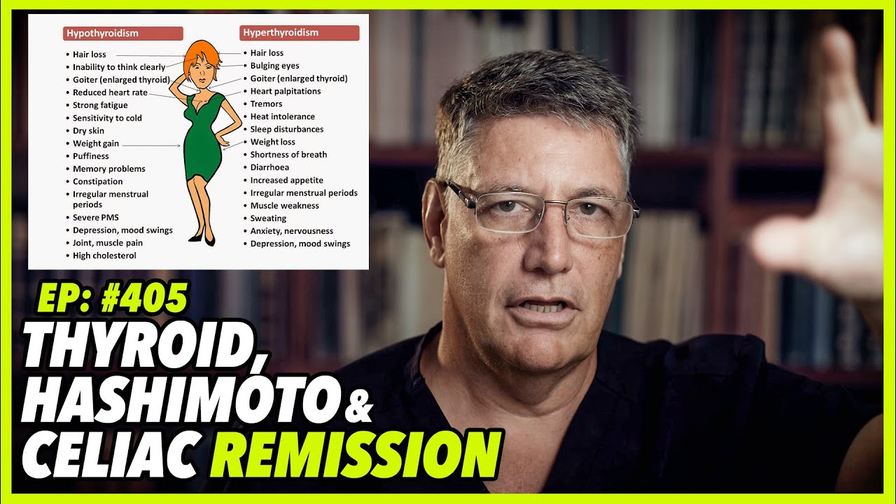 Ep:405 THYROID, HASHIMOTO AND CELIAC REMISSION