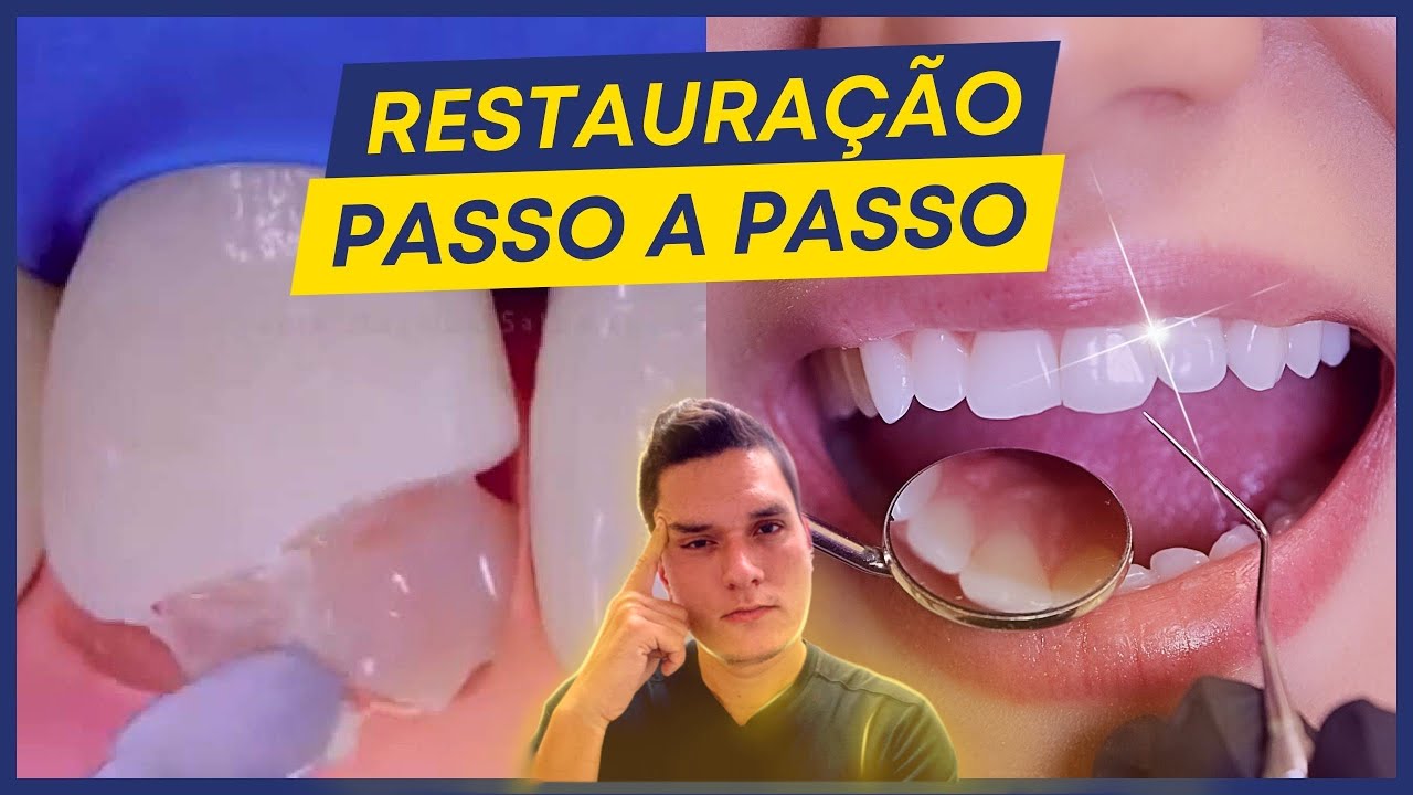 RESTAURAÇÃO EM RESINA COMPOSTA | PASSO A PASSO, COMO FUNCIONA?