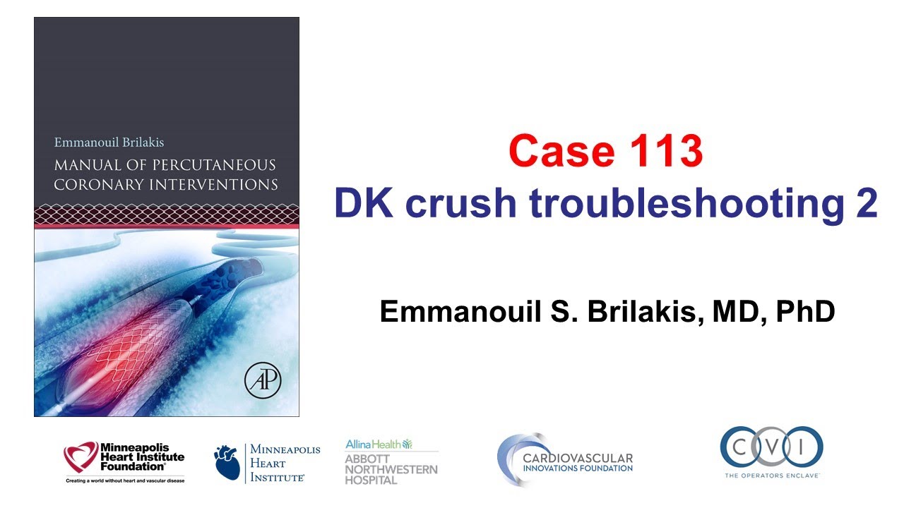 Дело 113: Руководство PCI — устранение неполадок DK Crush 2